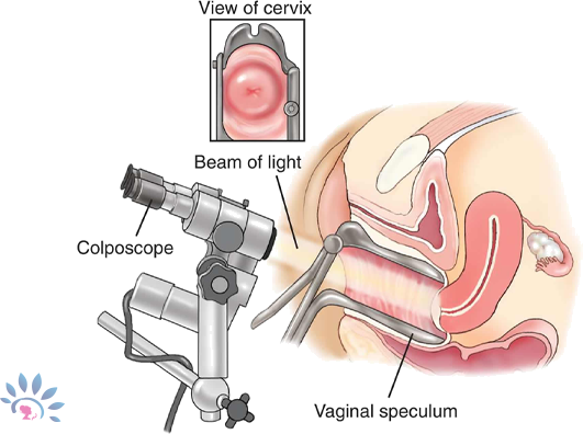 Akshaya Colposcopy