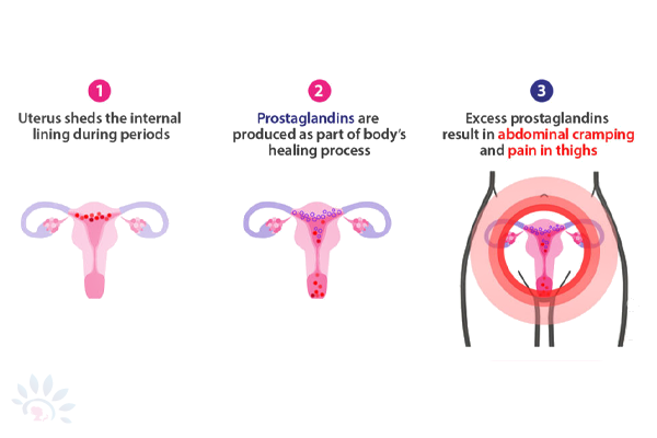 Akshaya Dysmenorrhea