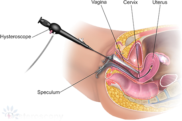 Akshaya Embryoscope