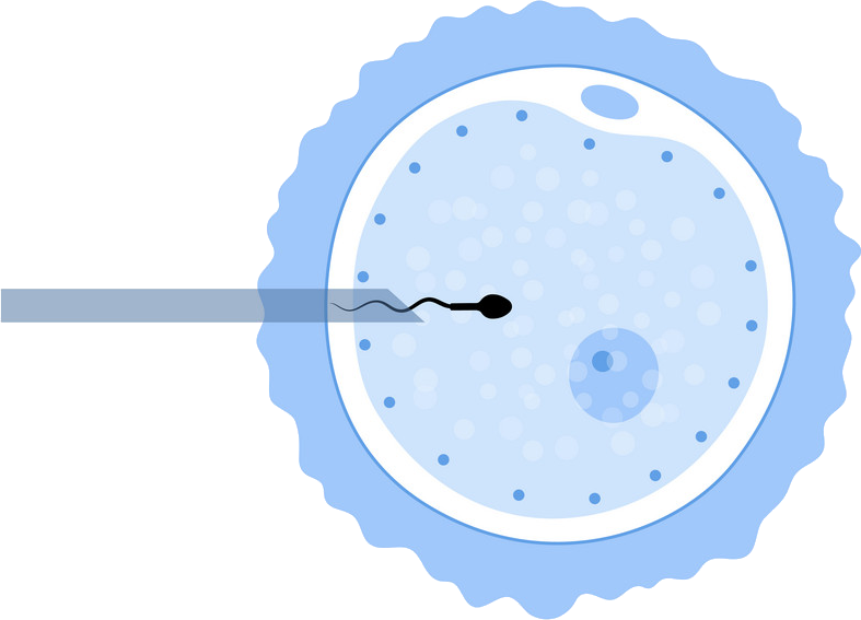 Akshaya Intracytoplasmic Sperm Injection (ICSI)