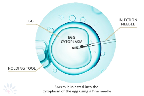 Akshaya Intrauterine Insemination (IUI)