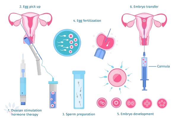Akshaya In Vitro Fertilization (IVF)